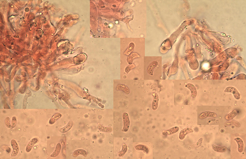 Hohenbuehelia cyphelliformis micro